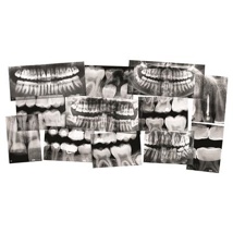 Dental X-Rays, Set of 10